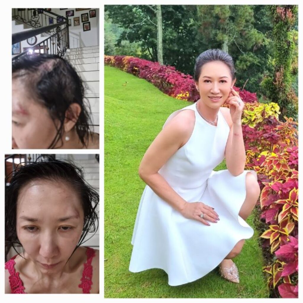 Sherly Chebing Bangkit dari Trauma, Menjadi Suara bagi Korban Kekerasan