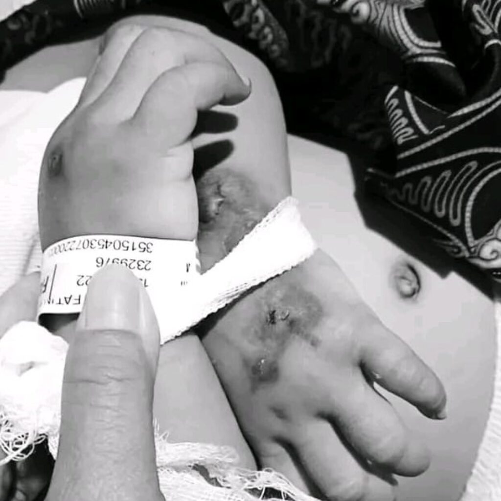 Seorang Balita Meninggal Dunia Usai Jalani Perawatan di Klinik Siaga Medika Candi Pari